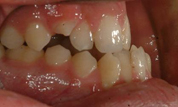 Patient1-before-bottom1