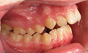 Patient13d-before-bottom1