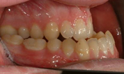 Patient2-before-bottom1