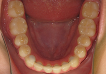 arch-after-01b1
