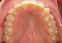 arch-after-02b