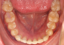 arch-after-02b1