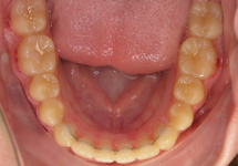 arch-after-03b1