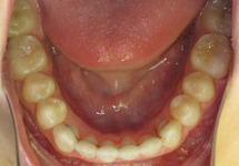 arch-after-04b1