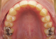 arch-after-05b