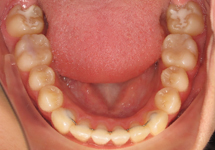 arch-after-05b1