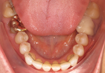 arch-after-06b1