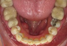 arch-after-08b1