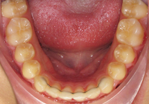 arch-after-09b1
