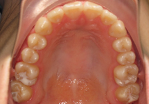 arch-after-19b