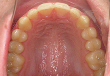 arch-after-25b