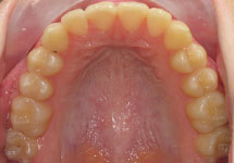 arch-after-27b