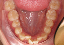 arch-before-01b1