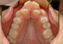 arch-before-02b