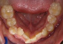 arch-before-02b1
