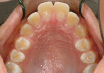 arch-before-03b