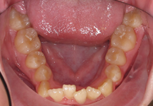arch-before-03b1