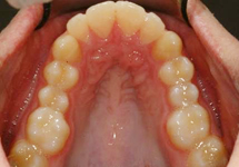 arch-before-04b