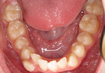 arch-before-04b1