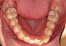 arch-before-05b1