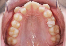 arch-before-06b
