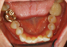 arch-before-06b1