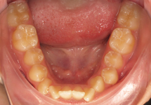 arch-before-09b1