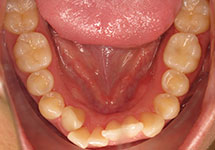arch-before-12b1