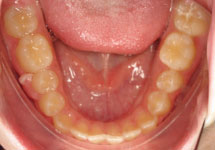 arch-before-13b1