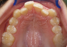 arch-before-16b