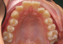 arch-before-19b