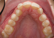 arch-before-21b