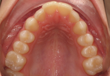 arch-before-22b