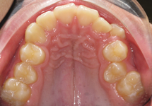 arch-before-24b