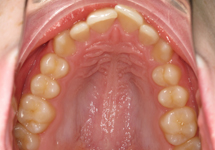 arch-before-25b