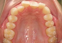 arch-before-26b