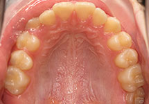 arch-before-27b