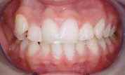 gallery-patient-08c-before-center