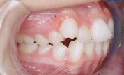 gallery-patient-08c-before-left