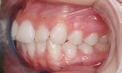gallery-patient-08c-before-right