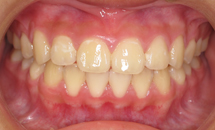 gallery-patient-13a-after