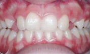 gallery-patient-15c-before-center