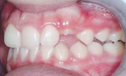 gallery-patient-15c-before-right