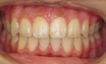 gallery-patient-16a-after