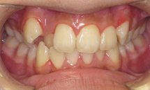 gallery-patient-16a-before