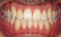 gallery-patient-19a-after