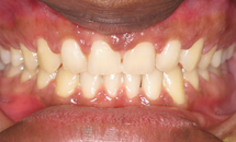 gallery-patient-21a-after
