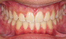 gallery-patient-25a-after