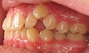 gallery-patient-40c-before-right